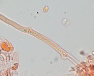 Sertulicium granuliferum